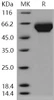 Human LILRB3/LIR3/ILT5/CD85a Recombinant Protein (His Tag) (RPES0488)