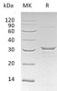 Human CLIC1 Recombinant Protein (RPES0490)