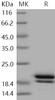 Human REG1B/PSPS2 Recombinant Protein (His Tag) (RPES0501)