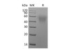 Mouse CD86/B7-2 Recombinant Protein (RPES0518)