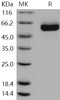 Human DLL1/Delta Recombinant Protein (His Tag) (Active) (RPES0521)
