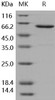 Human JAM-A/F11R Recombinant Protein (Fc Tag) (Active) (RPES0523)