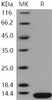 Beta-2-Microglobulin/B2M Recombinant Protein (RPES0527)