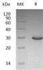 Human TRIM/TRAT1 Recombinant Protein (RPES0532)