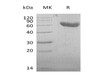 Mouse CD28/TP44 Recombinant Protein (RPES0536)