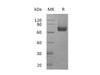 Mouse IL7RA/CD127 Recombinant Protein (RPES0554)
