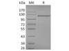 Human CD31/PECAM1 Recombinant Protein (RPES0555)