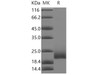 Human CD16b/FCGR3B Recombinant Protein  (RPES0557)
