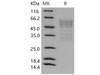 Mouse Syndecan/SDC1 Recombinant Protein (His Tag) (RPES0563)