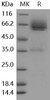 Mouse LYVE1/HAR Recombinant Protein (Fc Tag) (RPES0564)