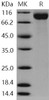 Human SIGLEC2/CD22 Recombinant Protein (aa 176-687, His Tag) (RPES0565)
