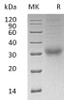 Human CGB3 Recombinant Protein (RPES0566)