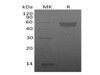 Mouse TIGIT Recombinant Protein (RPES0575)