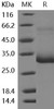 Mouse MBL2/MBL/COLEC1 Recombinant Protein (RPES0583)