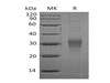 Mouse CD16-2/FCGR4 Recombinant Protein (RPES0592)