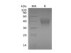 Mouse TIM-3/HAVCR2 Recombinant Protein (RPES0594)