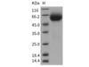 Rat IL18R1 Recombinant Protein (RPES0600)