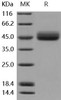 Mouse IL13RA2/CD213A2 Recombinant Protein (His Tag) (Active) (RPES0602)