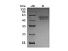 Mouse CD64/FCGR1 Recombinant Protein (RPES0609)