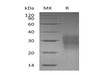 Mouse FAS/TNFRSF6 Recombinant Protein (RPES0611)