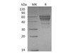Mouse TIM-3/HAVCR2 Recombinant Protein (RPES0613)
