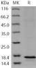 Human LTC4S/LTC4 synthase Recombinant Protein (His Tag) (RPES0616)