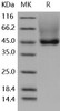 Human Decorin/DCN Recombinant Protein (RPES0618)
