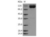 Rat IL18R1 Recombinant Protein (Fc Tag) (RPES0619)