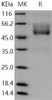 Human Mucin/MUC Recombinant Protein (Fc Tag) (RPES0621)