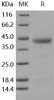 Human ESAM Recombinant Protein (RPES0639)