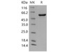 Mouse P4HB Recombinant Protein (His Tag) (Active) (RPES0641)