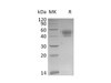 Mouse PD-L1/B7-H1/CD274 Recombinant Protein (RPES0669)