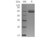 Osteoprotegerin/TNFRSF11B Recombinant Protein (RPES0670)