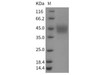 Rat IL-21R Recombinant Protein (His Tag) (Active) (RPES0677)