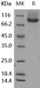 Human Neuropilin/NRP1 Recombinant Protein (His Tag) (Active) (RPES0680)
