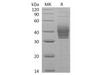 Human CLEC4E/Mincel Recombinant Protein (RPES0681)