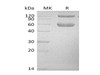 Mouse BMPRIA/ALK-3 Recombinant Protein (RPES0688)