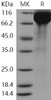 Human SIGLEC5 Recombinant Protein (Fc Tag) (RPES0697)