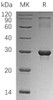 Human HGPRT/HPRT1 Recombinant Protein (RPES0700)