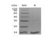 Human Thioredoxin-2/TXN2 Recombinant Protein (RPES0719)