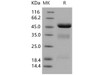 Human Urokinase/uPA Recombinant Protein (His Tag) (Active) (RPES0745)