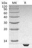 Human S100B Recombinant Protein (His Tag) (Active) (RPES0746)