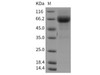 Rat LTBR/TNFRSF3 Recombinant Protein (Fc Tag) (RPES0747)