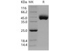 Human CD21/CR2/C3DR Recombinant Protein (His Tag) (Active) (RPES0763)
