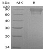 Coagulation Factor IX/F9 Recombinant Protein (RPES0769)