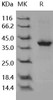 Human S100A2 Recombinant Protein (Fc Tag) (RPES0800)