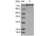 Human VEGFR3/FLT4 Recombinant Protein (His Tag) (Active) (RPES0818)