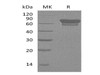 Mouse PD/PDCD1 Recombinant Protein (RPES0833)