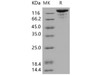 Human VEGFR3/FLT4 Recombinant Protein (Fc Tag) (Active) (RPES0836)