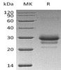 Human TFPI2 Recombinant Protein (RPES0844)